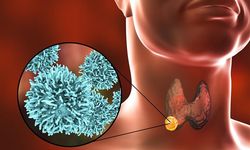 Tiroid nedir, Tiroid belirtileri nelerdir, Tiroid tedavisi