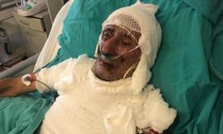 Cide’de kardeşini yakmaya çalıştığı iddia edilen sanığa 21 yıl hapis talebi