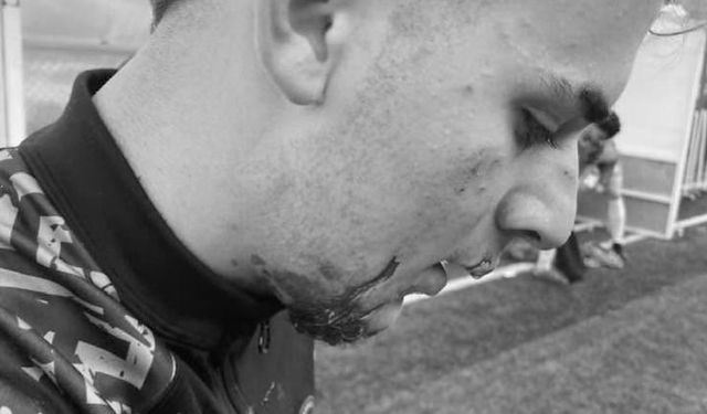 Kastamonu’da genç futbolcuya sportmenlik dışı saldırı!