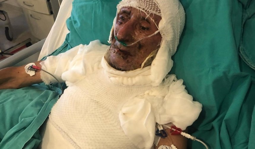 Cide’de kardeşini ahıra kilitleyip yaktığı iddia edilen sanık hakim karşısında