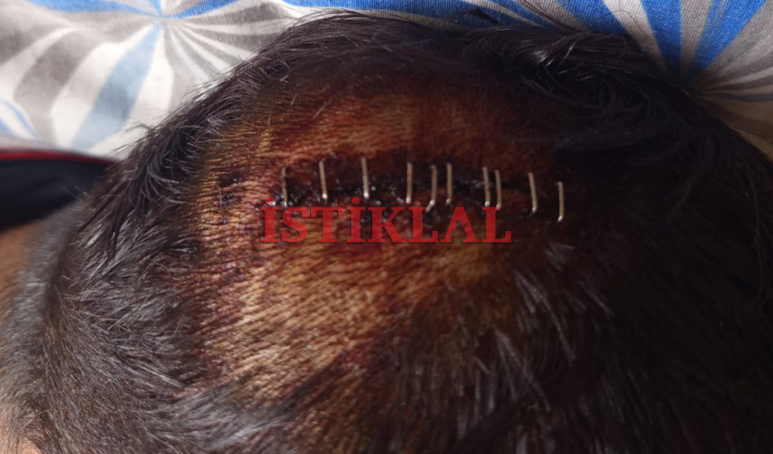 Kastamonu'da 16 Yaşındaki Genç Sokak Ortasında Darp Edildi (2)