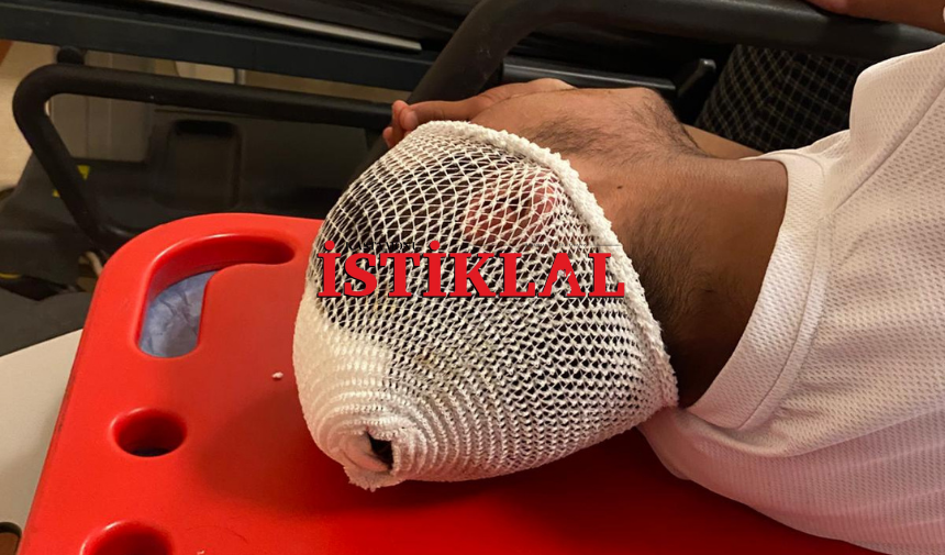 Kastamonu'da 16 Yaşındaki Genç Sokak Ortasında Darp Edildi (3)