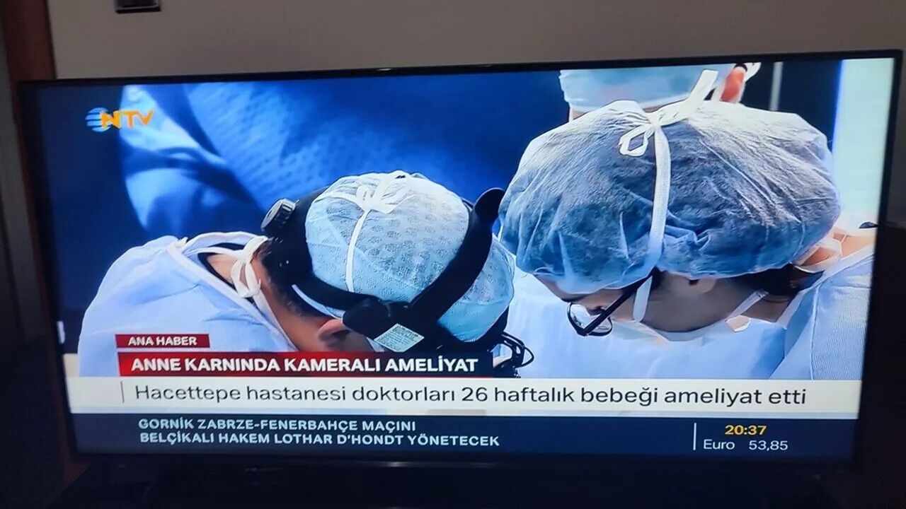 Kastamonulu Anne Ve Bebeği Tıp Tarihine Geçti!1